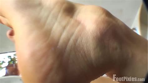 Chiropractic Nude Search XVIDEOS