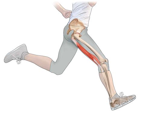 Hamstring Injuries Biceps Femoris Semitendinosus Semimembranosus