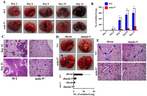 Lung Metastasis Development Is Inhibited In Mice Lacking Download