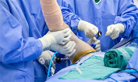 orthopedic trauma surgeons  northern california trauma