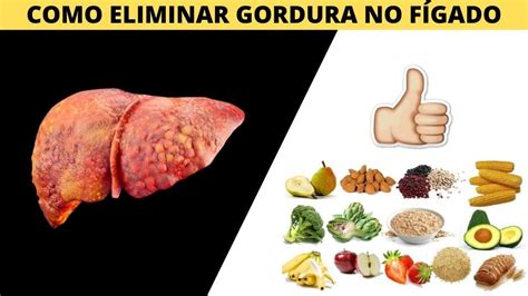 COMO ELIMINAR GORDURA NO FÍGADO 5 Receitas destruidoras de gordura no