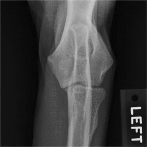 Diagnostic Imaging Cumulative Flashcards Quizlet