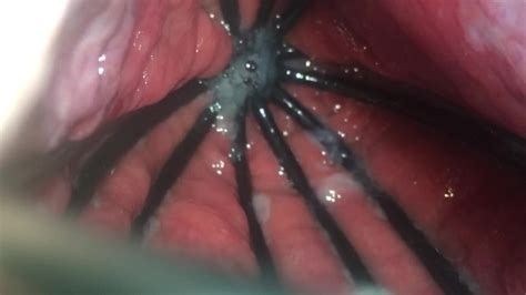 Whisk Up His Ass Nice Look Inside The Hole Free Xxx Mobile Videos Honeys
