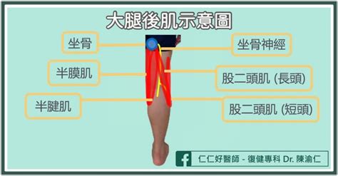 運動完大腿後側肌肉好痛？一分鐘判斷是不是「大腿後肌拉傷」 健康遠見