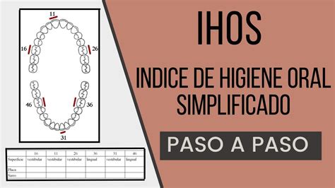 Indice IHOS Indice de Higiene Oral Simplificado Odontología Con Cri