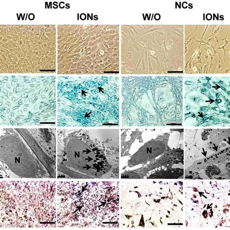 Comparison Of Hmscs Differentiation Capacity Into Ncs With Or Without