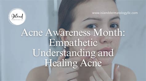 Acne Awareness Month Empathetic Understanding And Healing Acne