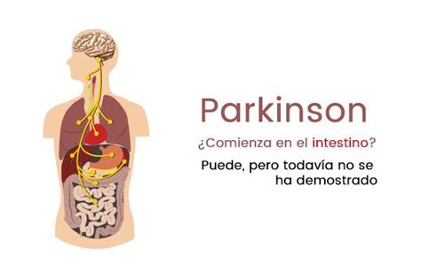 ¿el Párkinson Comienza En El Intestino Puede Pero Este No Es El