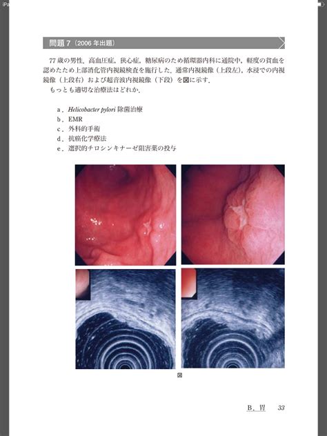 電子書籍版｜日本消化器病学会専門医資格認定試験問題・解答と解説 第6集 M2plus