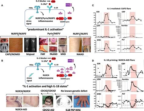 Frontiers Human Autoinflammatory Diseases Mediated By Nlrp Pyrin