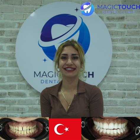 Beforeafter Magictouch Dental Clinic Turkey