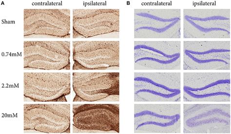 Frontiers A Standardized Protocol For Stereotaxic Intrahippocampal