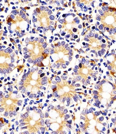 Rabbit Anti I O Polyclonal Antibody C Term Absin