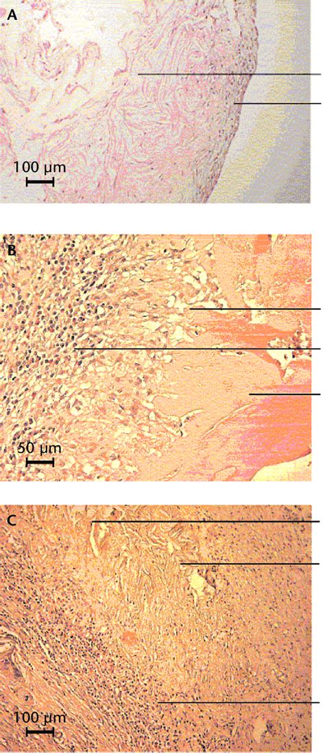 Histological Sections From Rabbits Treated With Tachocomb ® Following