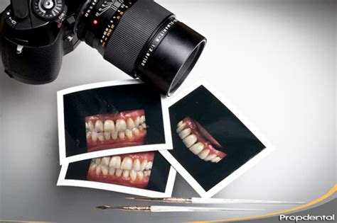 La fotografía digital dental revoluciona la odontología