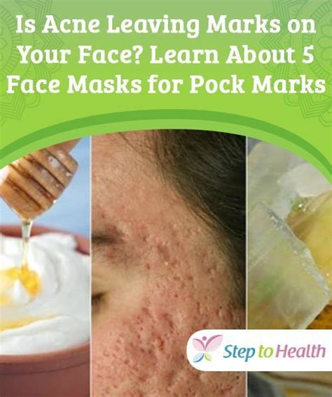 Pock marks on face treatment - dikisb