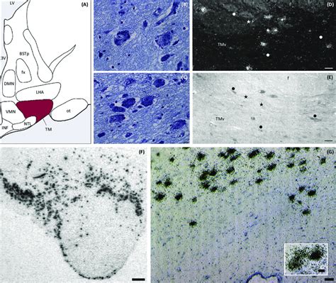 Location Of Human Tuberomamillary Nucleus Tmn Typical Tmn Neurons