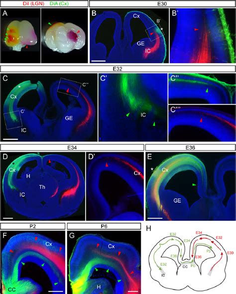 Development Of Major Axon Fiber Systems In The Cerebral Cortex A