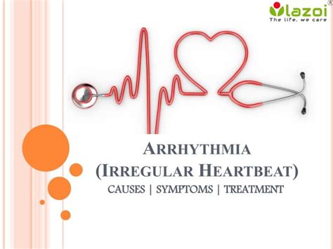 Arrhythmia Causes Symptoms And Treatment Ppt