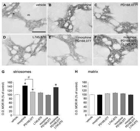 Ijms Free Full Text Dopamine D4 Receptor Counteracts Morphine