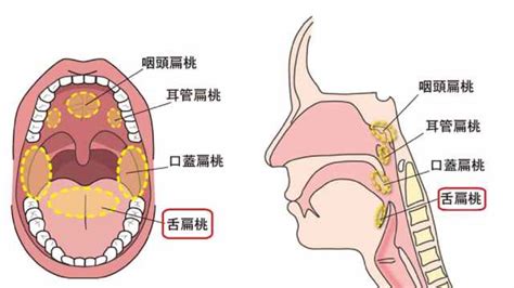 扁桃とは？｜医学的見地から