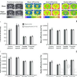 The Effects Of Hypoperfusion On Diffusion Tensor Imaging DTI Indices