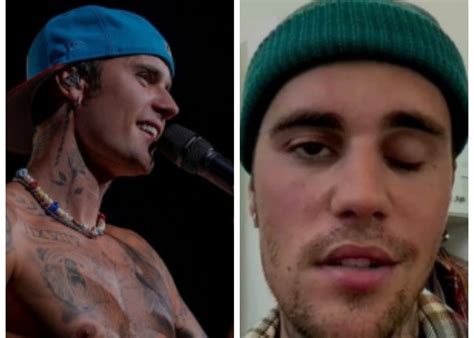 Justin Bieber reveals shocking facial paralysis [watch] - AffluenceR