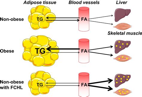 In And Out Adipose Tissue Lipid Turnover In Obesity And Dyslipidemia