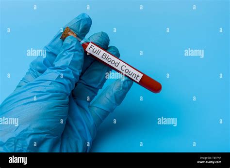 Hand Holding A Test For A Full Blood Test In A Test Tube On A Blue