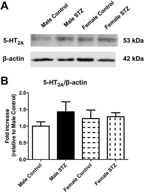 Protein Expression Of 5 Ht 2a Receptors In Carotid Arteries A