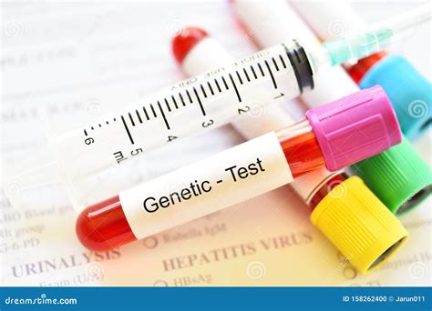 Blood Sample For Genetic Testing Stock Photo Image Of Exam Blood