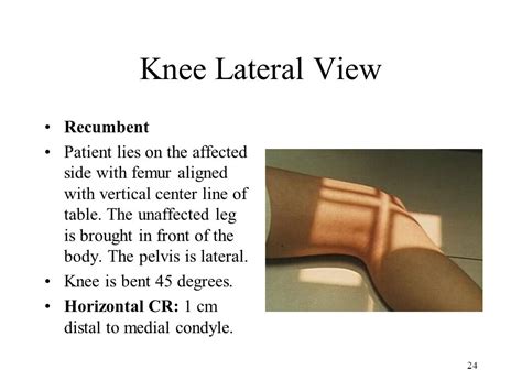 Radiographic Positioning Of The Knee