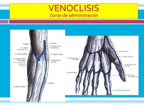 2011 3 Via Endovenosa Venoclisis Ppt