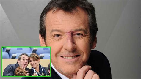 Jean Luc Reichmann Cette Adorable D Claration Damour En Pleine