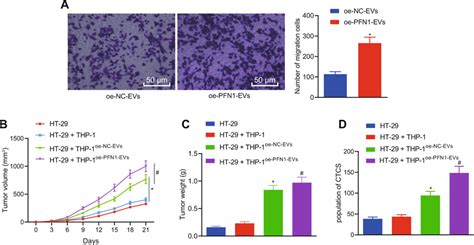 Pfn1 From Tumor Derived Evs Mediates The M2 Polarization Of Macrophage Download Scientific