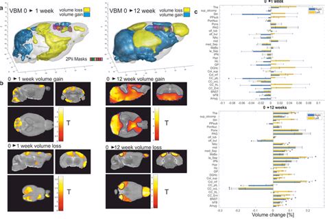 Longitudinal Assessment Of Brain Volume Changes With VBM A