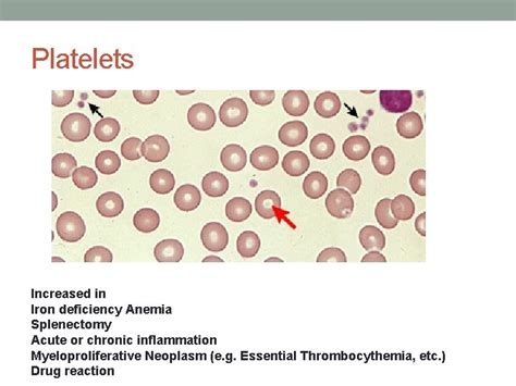 INTRODUCTION TO THE PERIPHERAL BLOOD SMEAR Rafi Ahmed 