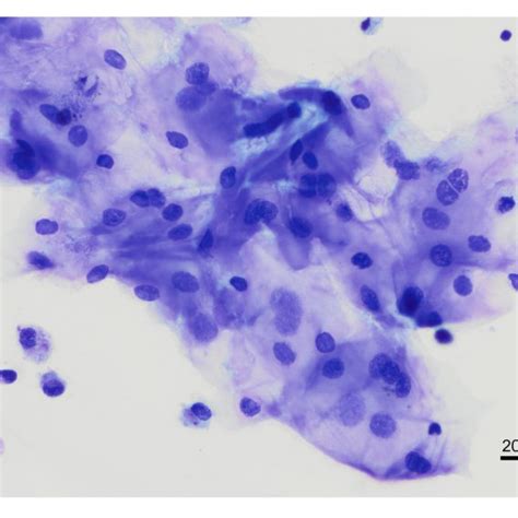 | Mucus observation in a bronchoalveolar lavage cytology from a healthy ...