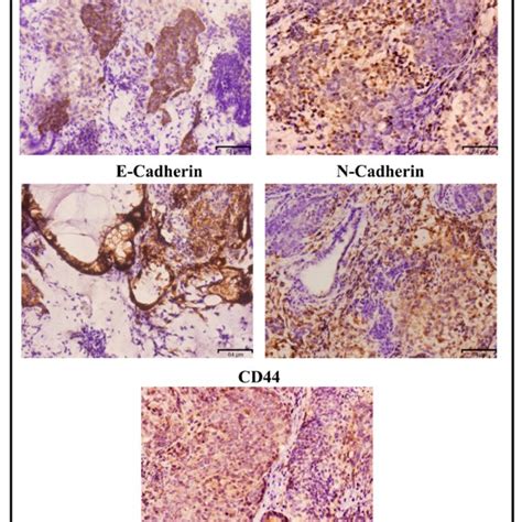 Immuno Histochemistry Ihc Of Mips Plccm Cells Derived Tumor In The