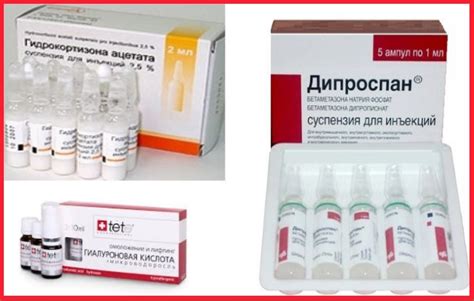 Лечение артроза коленного сустава: традиционные методы терапии ...