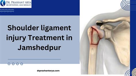 PPT - Shoulder ligament injury Treatment in Jamshedpur PowerPoint ...