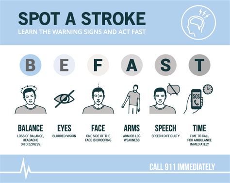 Is It a Stroke? Time to BE FAST | Methodist Health System | Omaha ...