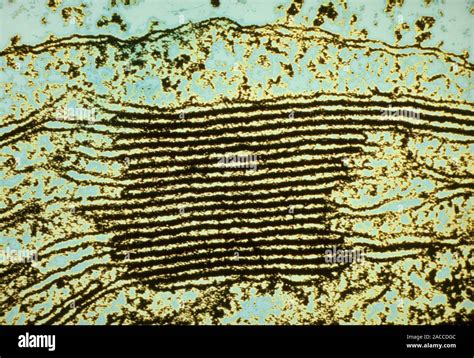 False Colour Transmission Electron Micrograph TEM Of A Stack Of Grana