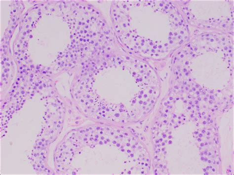 Testis And Epididymis Normal Histology Nus Pathweb Nus Pathweb