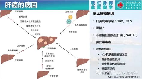 肝癌发病的主要原因有哪些？再造人