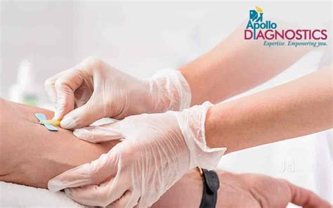 Apollo Diagnostics In Falnir Mangalore Best Diagnostic Centres In