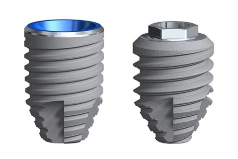 Implantes dentales cortos Implantología dental en Santander