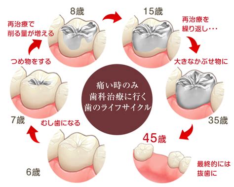 むし歯予防・歯周病予防 診療案内 横浜市青葉区の歯医者さん あおば台デンタルクリニック