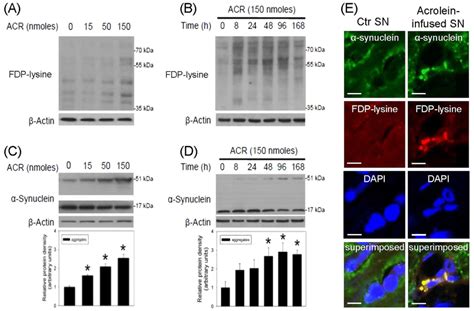 Intranigral Infusion Of Acrolein Induced Protein Conjugation And