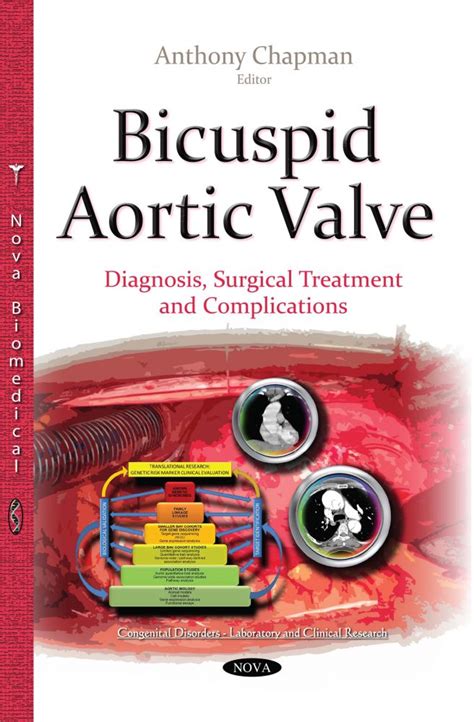 Bicuspid Aortic Valve: Diagnosis, Surgical Treatment and Complications – Nova Science Publishers